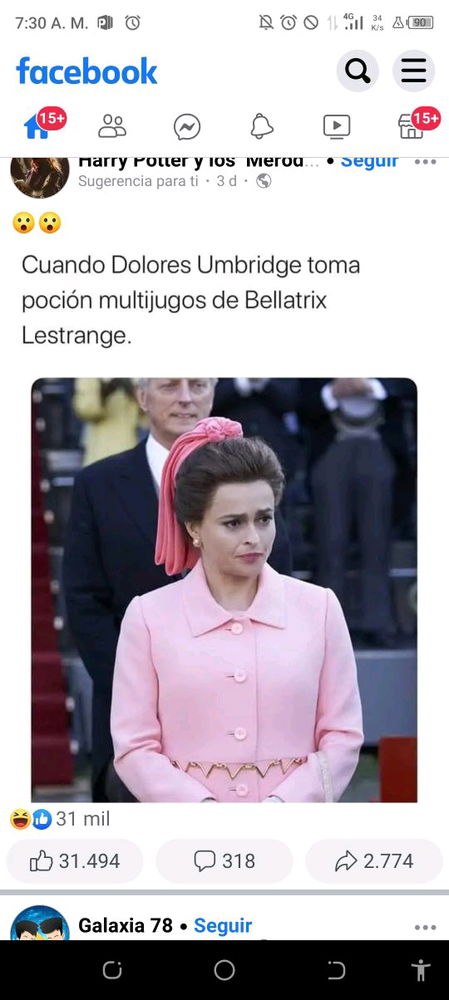Se confundió de cabello 