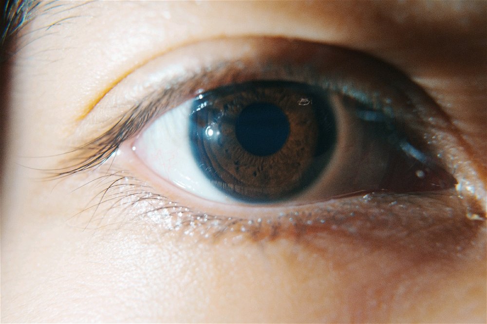 the eye