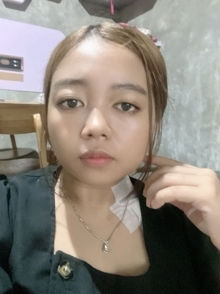 2 times surgery couldnt stop me from living