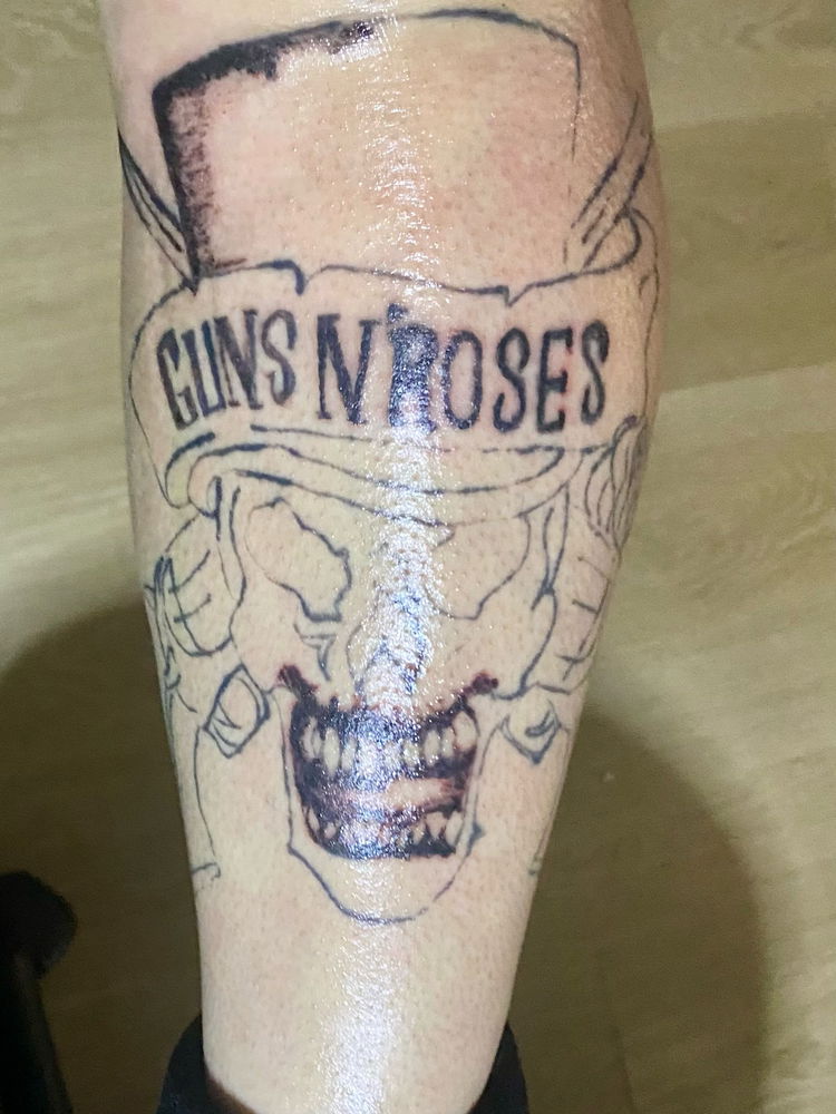 GnR
