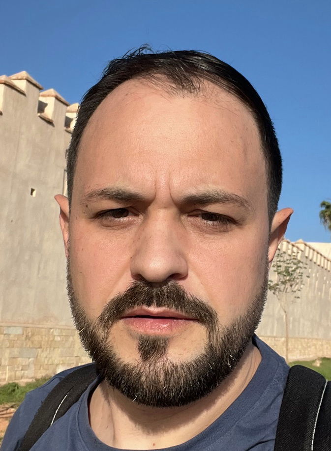 Please advise🤔 bearded or not. Appreciate your time to think and click.