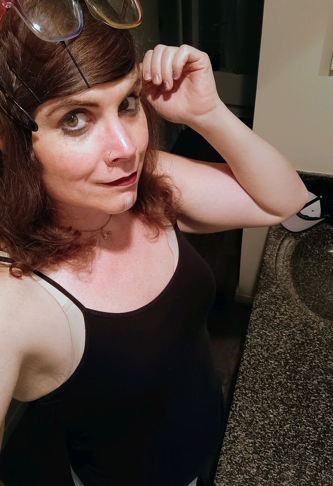 Had Feminization Facial Surgery Revision Today