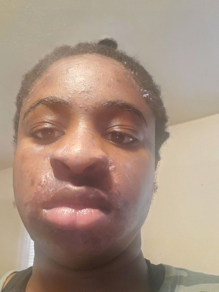 Taking care of myself