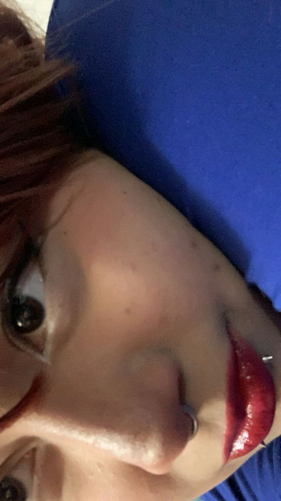 :P
