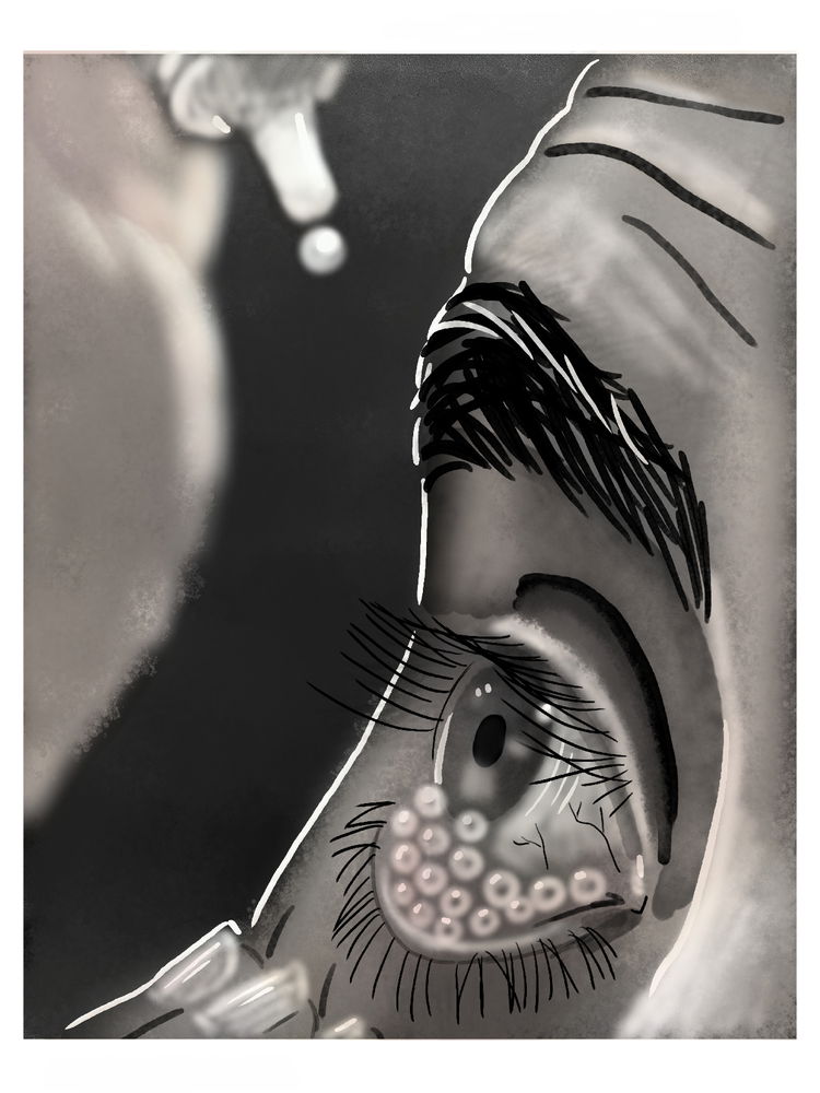 Body horror
