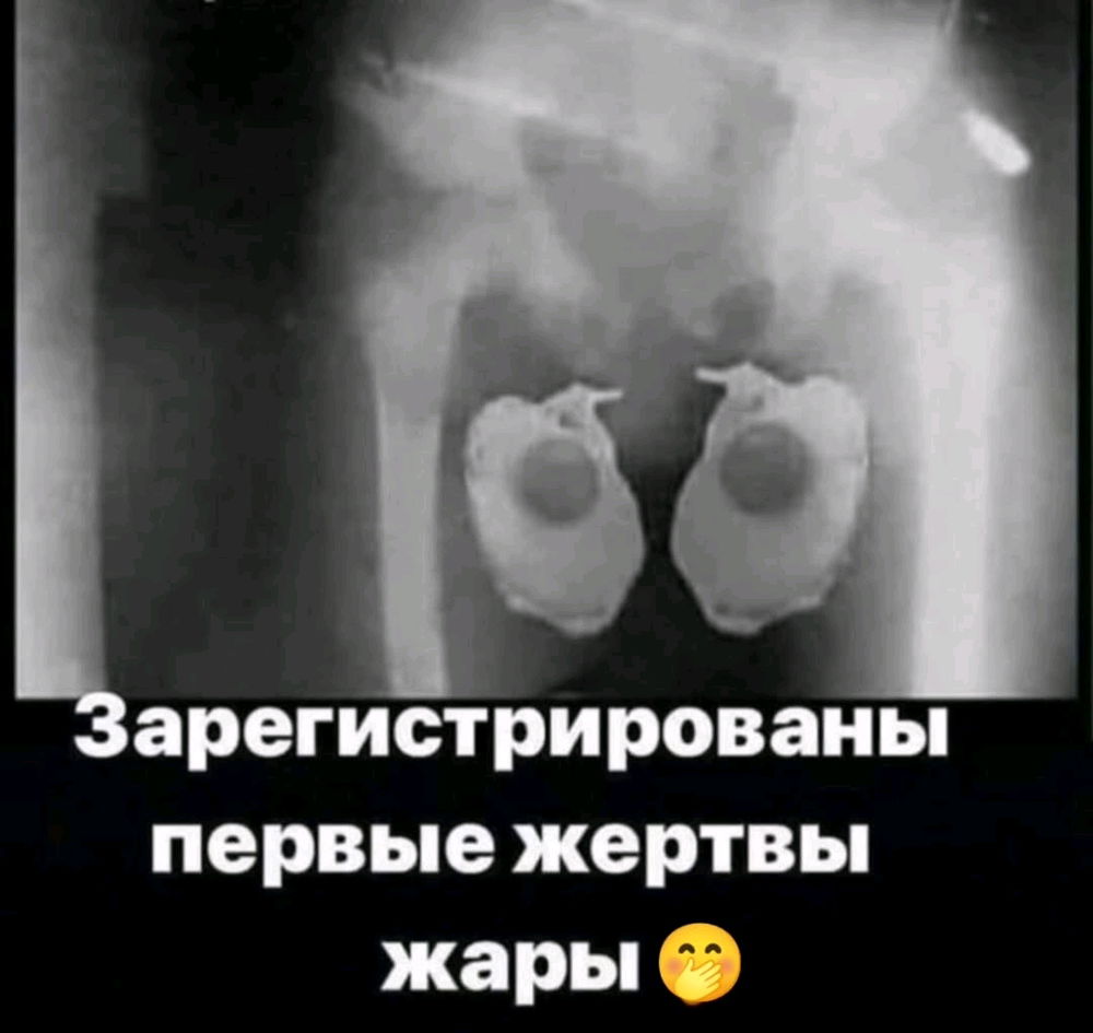 🤣🤣🤣🤣🤣