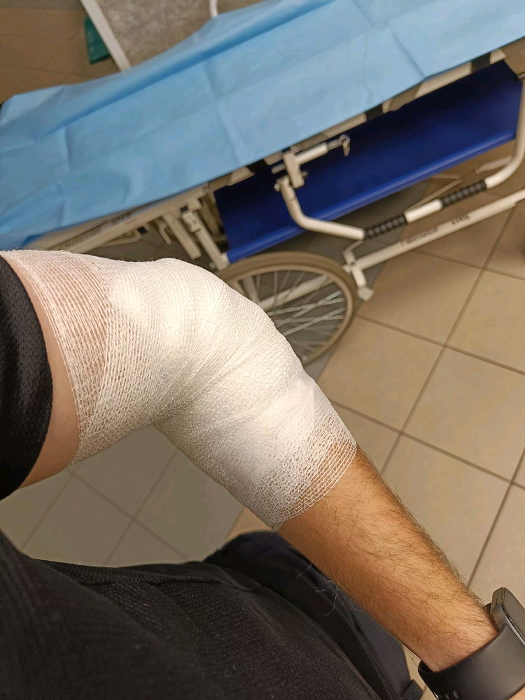 Kdo máte psa, tak si ho laskavě hlidejte a když víte, že je nebezpečný, tak košík. Uměl bych si představit i lepší večerní program než návštěvu pohovosti s pokousanou rukou (šlachy a nervy prý snad budu mít ok).