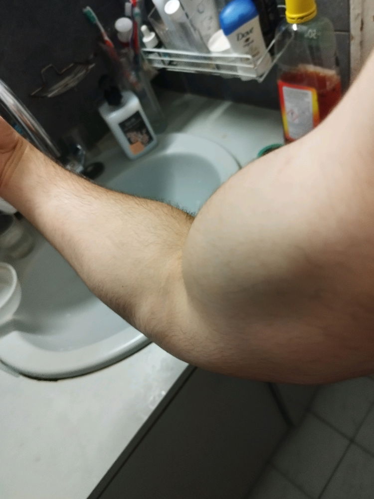 💪