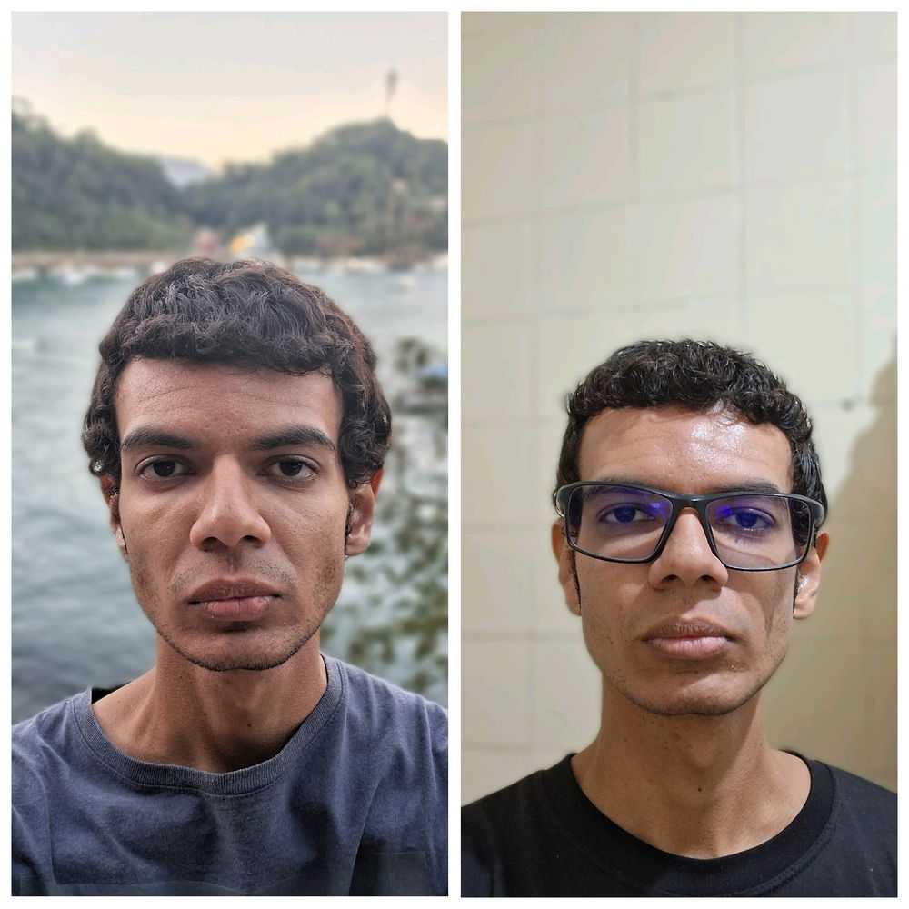 Pessoal sem zueira por favor, eu faço uso do clonazepam (rivotril) a um bom tempo, tem gente que diz que eu so vivo com cara de sono ou cansado, olhando essas 2 fotos aqui a primeira eu estava a base de rivotril a segunda eu estava sem, você acha que pode ser isso mesmo?