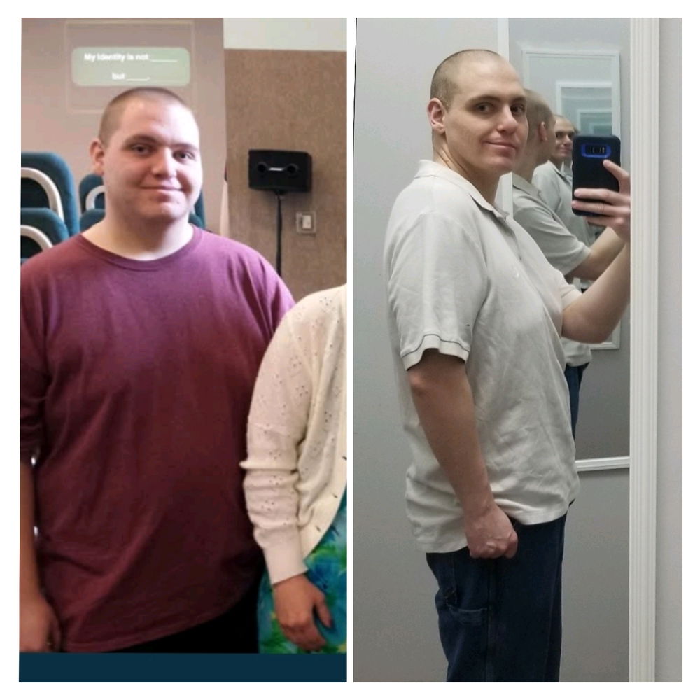 Weight Loss