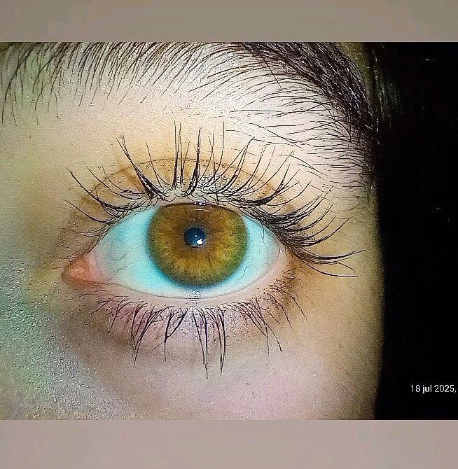 Ojo