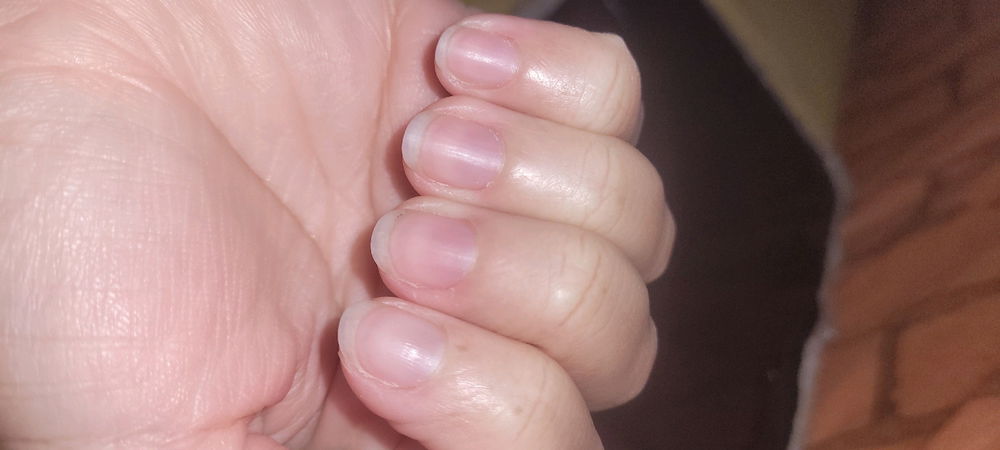 Eu não fico mais roendo as unhas💅