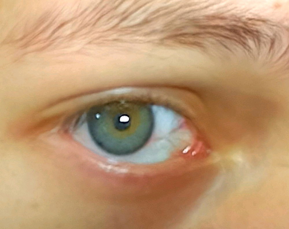 Foto ojo 👁️