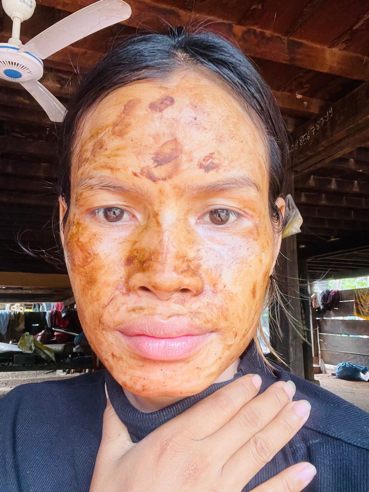 What happened with my face