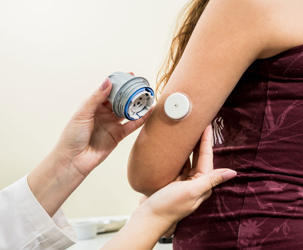 Glucose sensors
