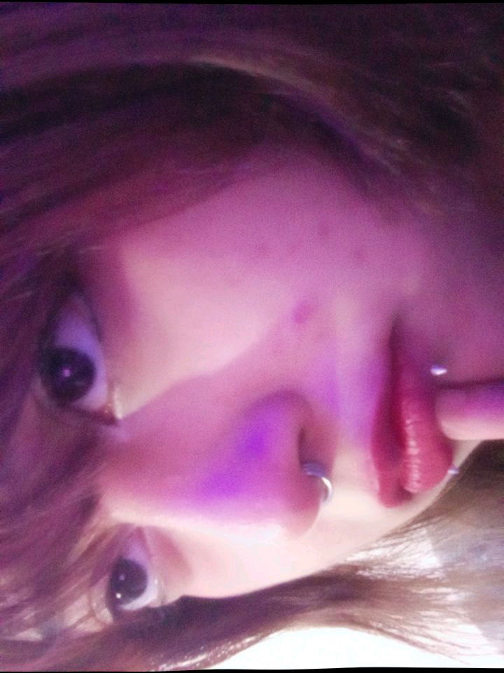 :5