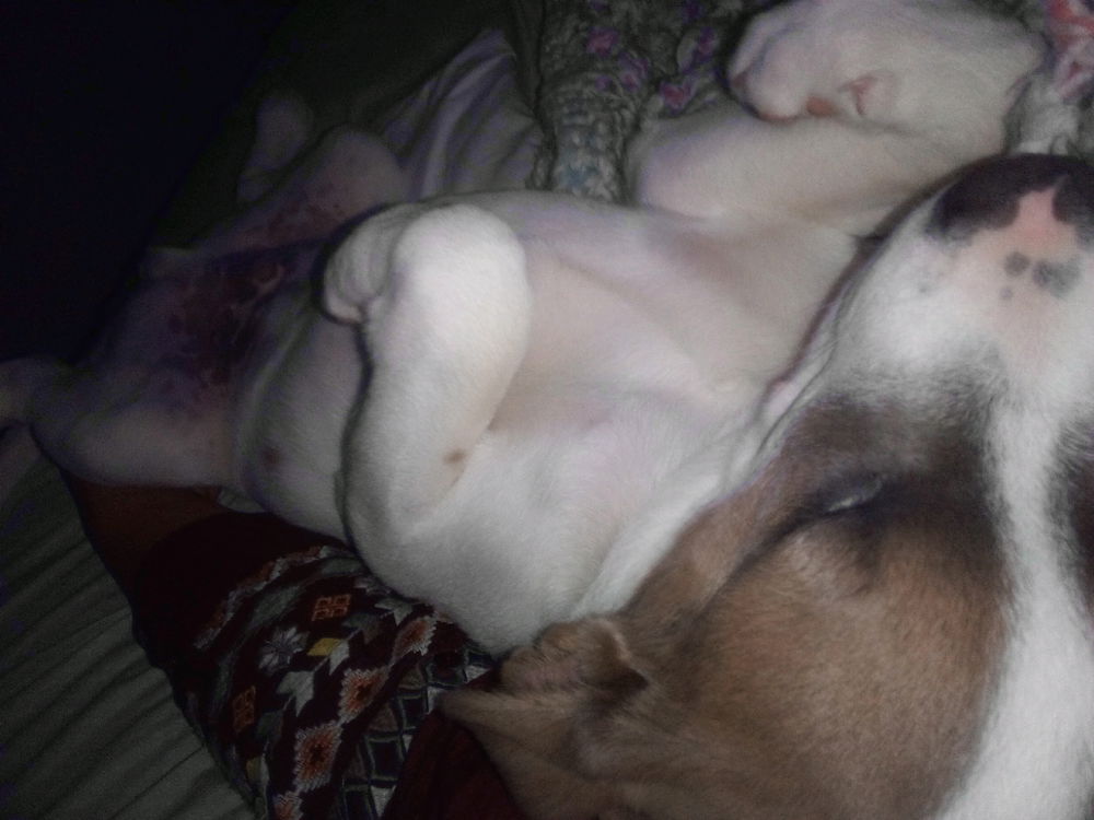 Trapped in cuddle arm seized