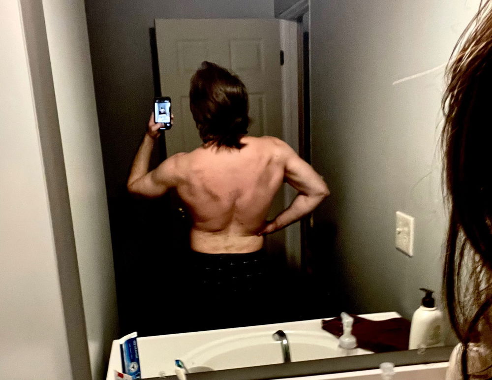 back day