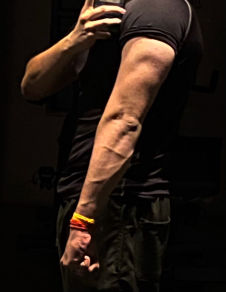 Yo