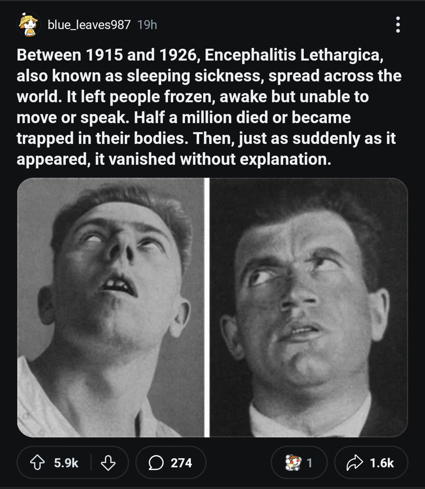 Encephalitis Lethargica 🧟‍♂️